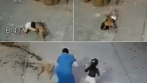 浪犬啃女童「撞倒咬掉臉頰肉」　驚悚20秒！媽媽救女也遇襲