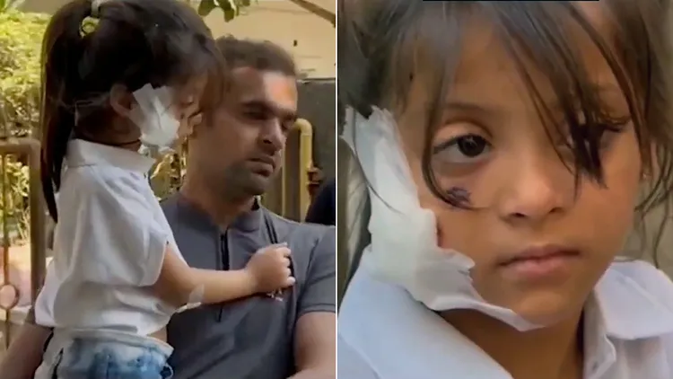 女童臉頰被流浪狗攻擊受傷。翻攝自推特