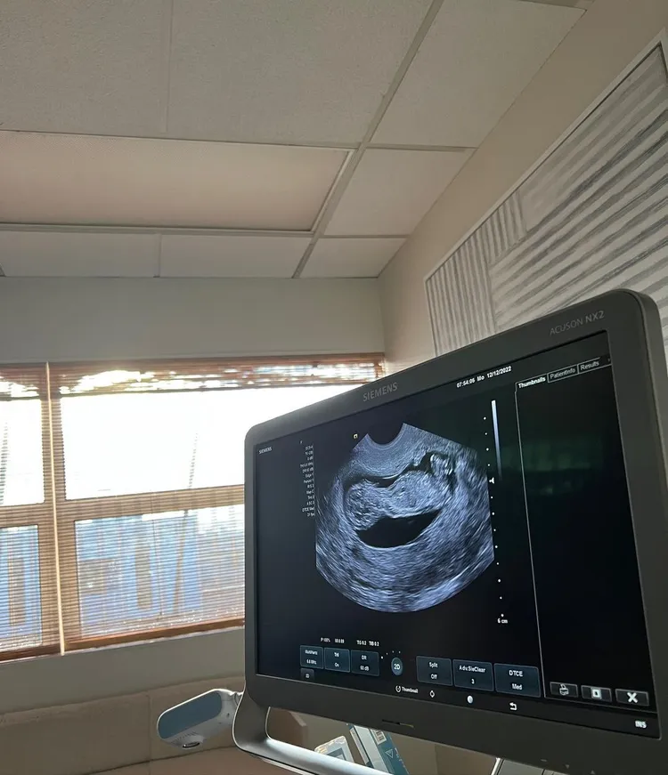 大坂直美po出胎兒超音波照。  翻攝naomiosaka  IG