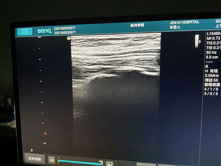 醫用超音波可提供更好影像解析度，近年來廣泛地使用在脊椎神經與周邊神經等的止痛與增生治療。大里仁愛醫院提供