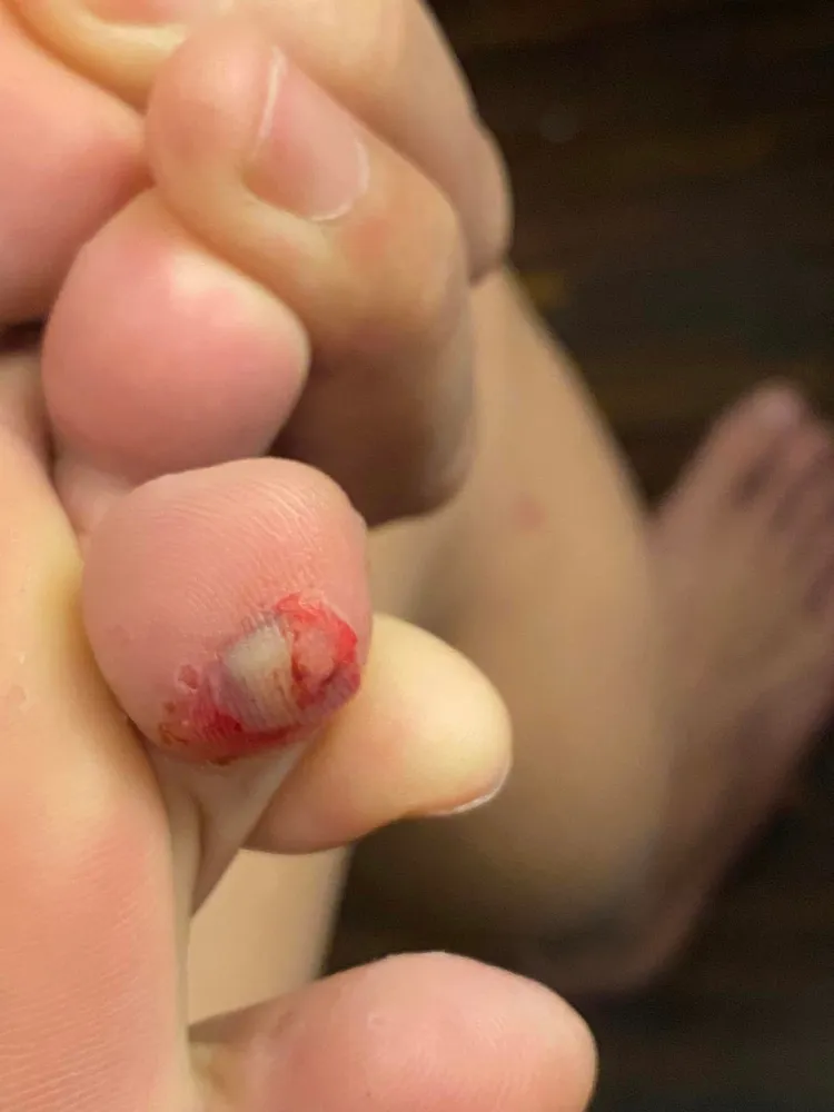 住客多處割傷。翻攝臉書社團《爆料公社》