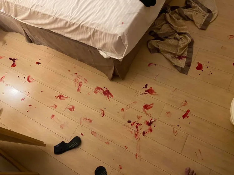 住客遭到玻璃割傷，現場血跡斑斑，他驚呼「像凶殺案」。翻攝臉書社團《爆料公社》。