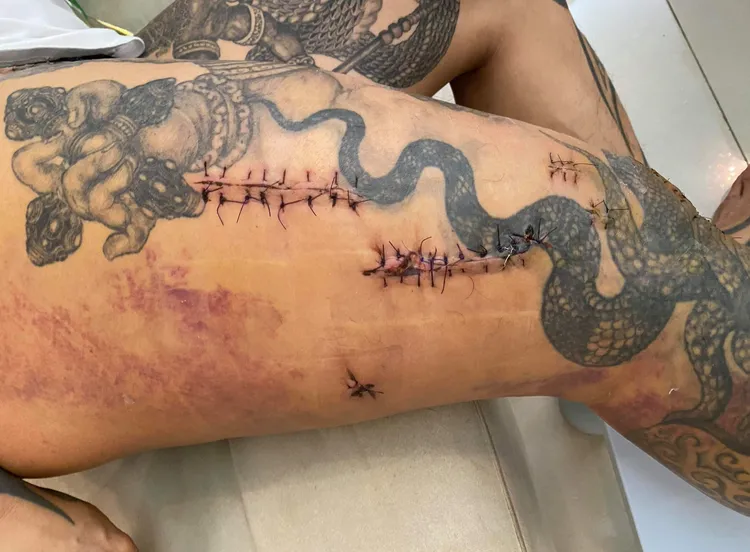 館長遭槍擊傷口。翻攝臉書/剽悍