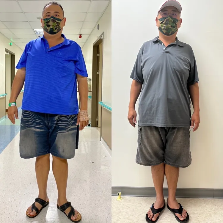 于先生成功甩肉21公斤。小港醫院提供