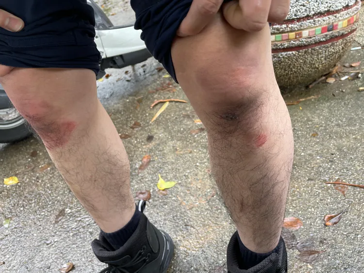 警員膝蓋遭磨破受傷。淡水警分局提供