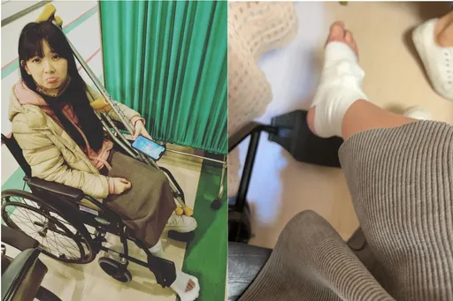 優格姐姐摔到骨折!實況主老公心疼「徵讚給5倍紅包」 驚嚇喊:初四了