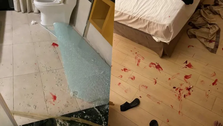 宜蘭一家溫泉會館玻璃爆裂，造成住客全身割傷，也讓玻璃門的安全性再度引起討論。翻攝臉書社團《爆料公社》