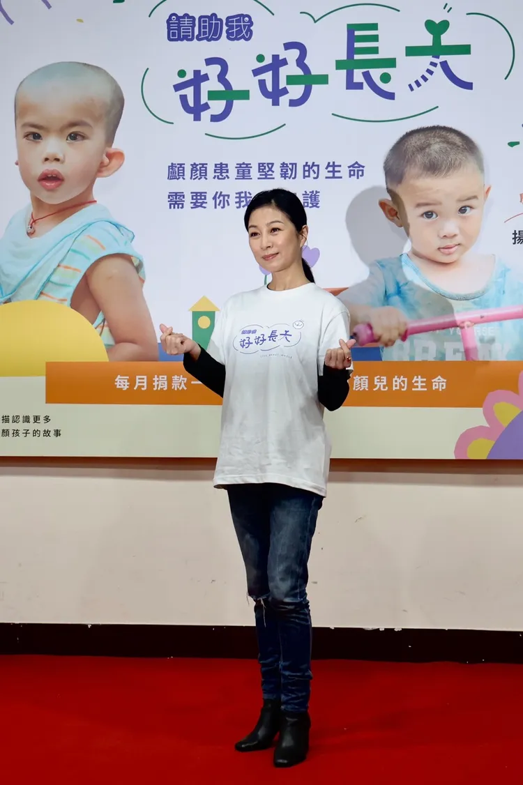 方文琳期盼社會大眾一起捐款幫助這群顱顏小天使們好好長大。林林攝