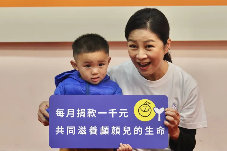 揚揚（左）出生後才得知患有唇腭裂。林林攝