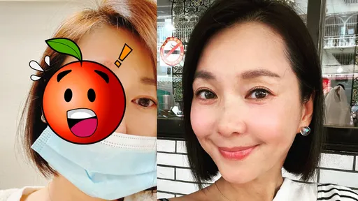 驚!六月露營出意外 半臉擦傷眼睛冒血腫到睜不開