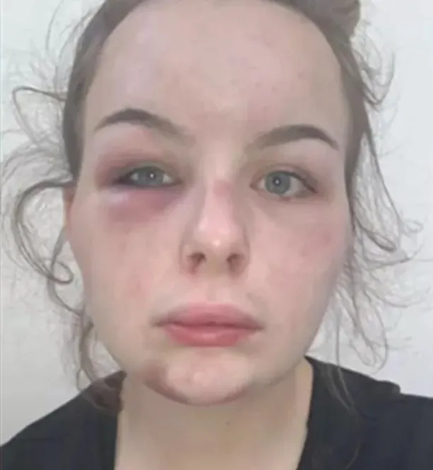 伊蓮娜在社群媒體貼出自己的復原照，聲稱網友的鼓勵讓她康復的更快。翻攝Facebook/ Eleanor Williams