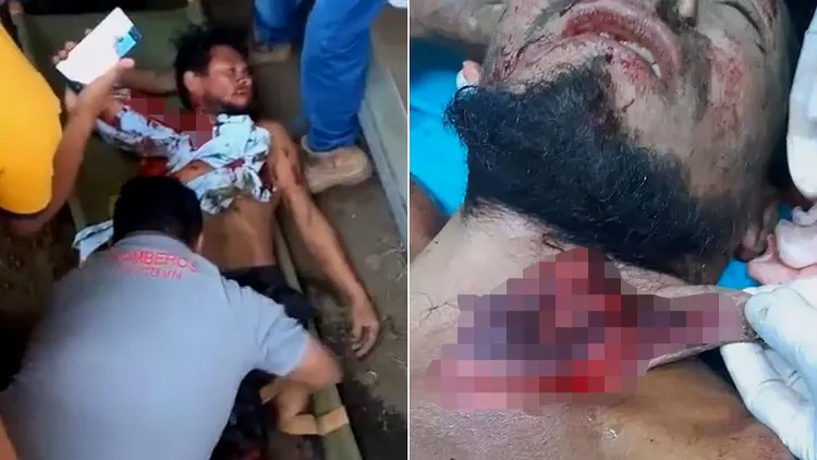 弗朗西斯頸部被牛角割開一個巨大傷口。翻攝自推特