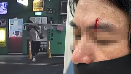 繳完停車費小跑步去牽車 遭柵欄砸臉!他滿臉血縫八針