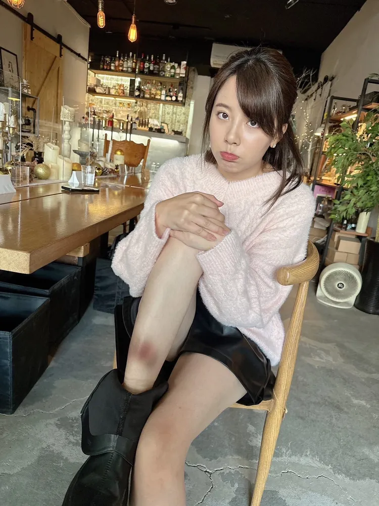 王上菲拍戲時不慎受傷。緯來提供