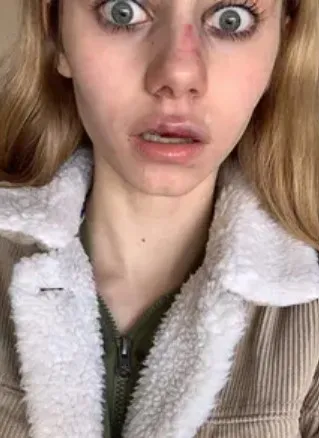 美少女阿德里亞娜遭到霸凌後身心崩潰的照片令人無比痛心。翻攝臉書Adriana Kuch