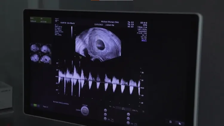 楊祐寧上個月透過IG宣布升格2寶爸的喜訊。翻攝yoyang IG