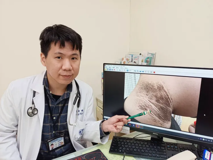 胡書瑋醫師筆指處即為國三男生脖子出現的黑色棘皮症狀。院方提供