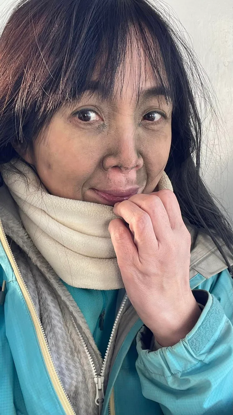 玉山北峰的陡坡狂風沙石讓她變這樣。鄭姓女登山客授權使用