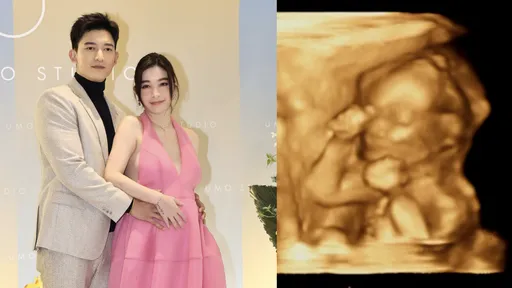 王家梁曬女兒超音波照「握拳比讚」　新手奶爸最擔心這件事