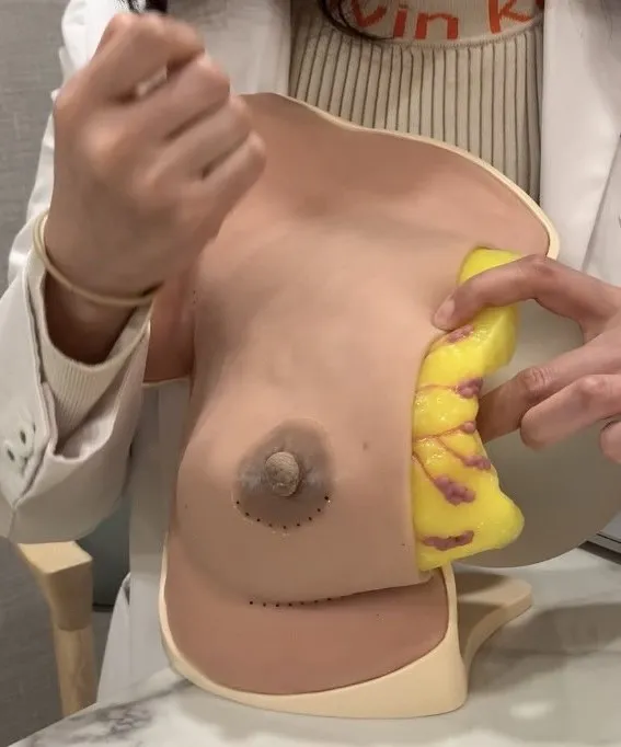 賴雅薇醫師以乳房模型試範，指其右手位置若持手電筒往下照光，是有可能看到隆乳女性胸前的果凍矽膠隆乳物。吳慧芬攝