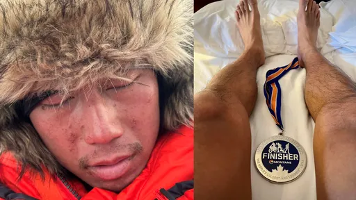 陳彥博極地賽後昏睡4天 夜夜驚醒大叫!3處肌肉被身體吃了