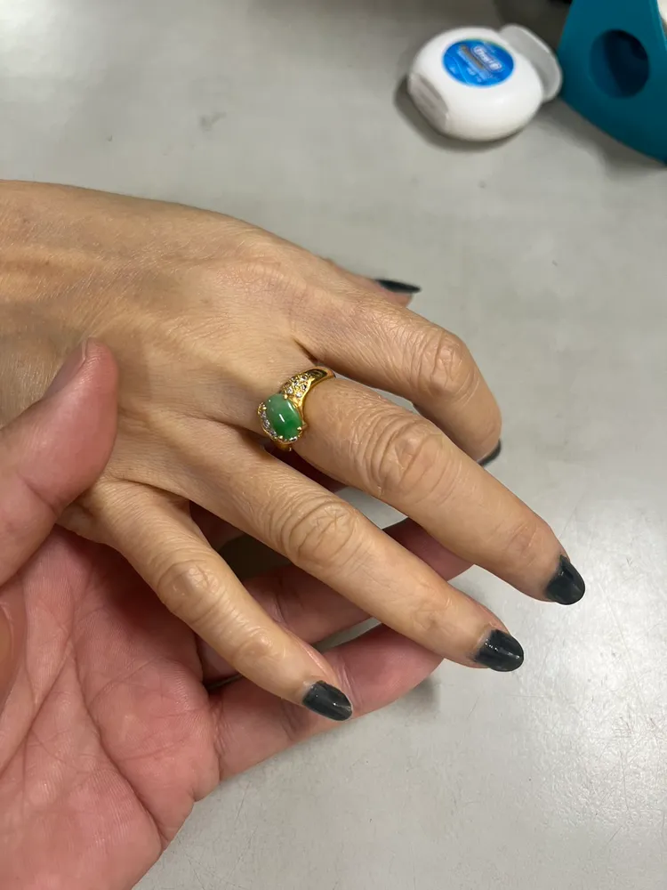 黃國峰協助民眾成功脫除戒指。黃國峰提供