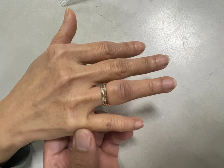 黃國峰曾救援過的卡戒狀況。黃國峰提供