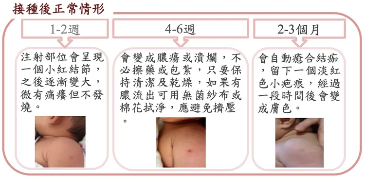 翻攝 疾管署官網