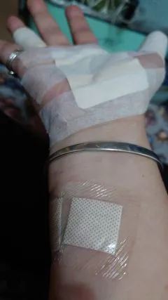 婦人規勸男子，男子還回「淋北就故意的，怎樣！」，讓她氣得拍桌，連玉鐲都拍碎、手也受傷。翻攝婦人臉書