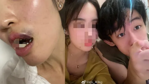 星二代家暴女友「打到滿嘴是血」 還嗆:女人不聽話就要收拾