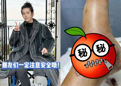 《小時代》男星下半身藏隱情 陳學冬傷勢嚴重竟萎縮了