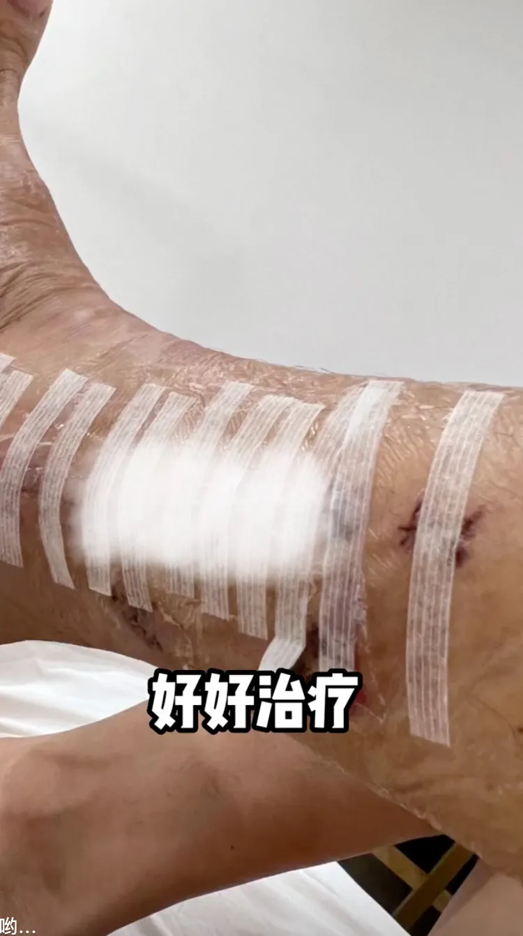 陳學冬傷勢嚴重縫了不少針。翻攝陳學冬抖音