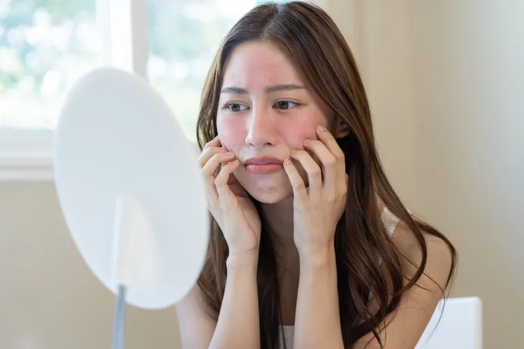 部分民眾可能在施打玻尿酸後出現過敏反應。主辦單位提供