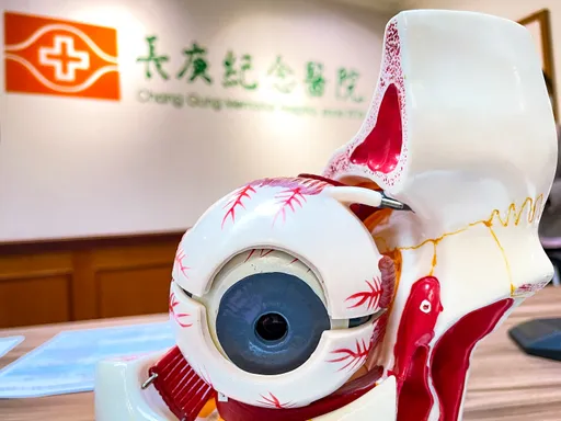 靈魂之窗也長癌!黑色素瘤害她視力扭曲 林口長庚「黃金治療」免摘眼球