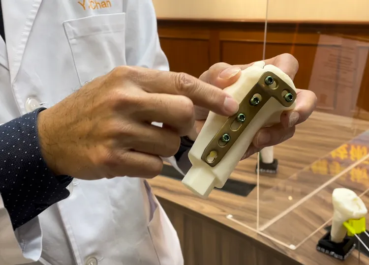 膝關節手術使用的骨板。林志怡攝