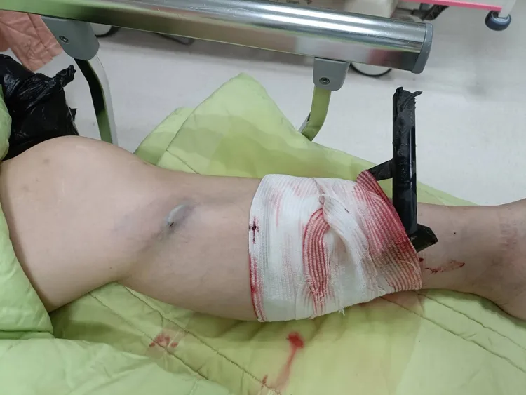 經警消鋸斷中柱、簡易包紮後，將李小姐連人帶中柱送抵大同醫院。讀者提供