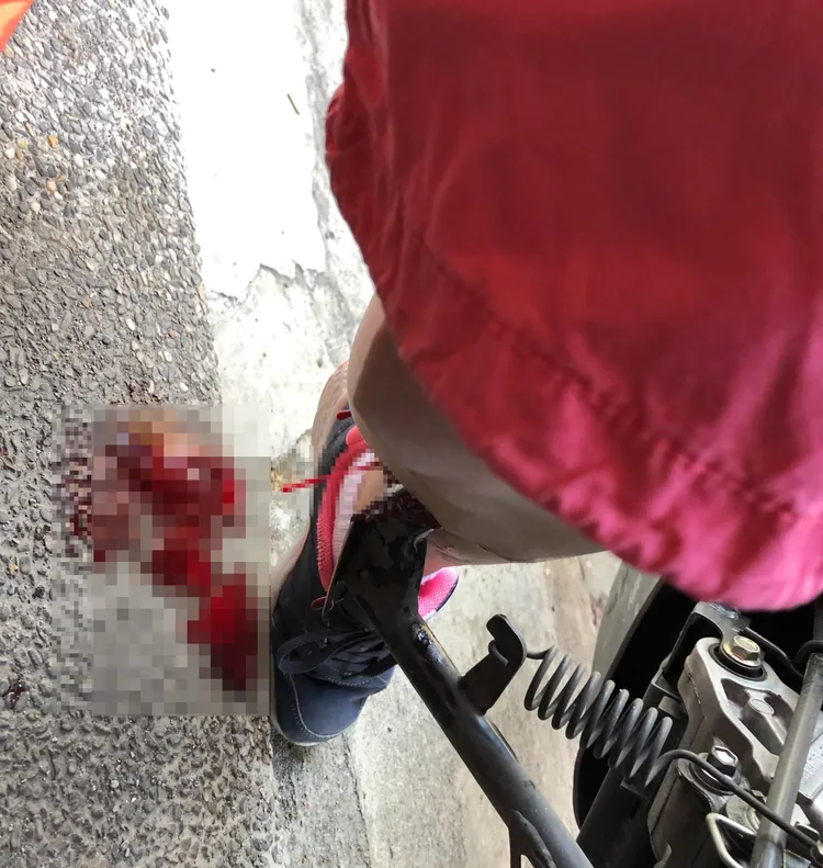 李小姐發現停機車立中柱時，車子暴衝，整隻中柱插進她的左小腿裡，濃稠的鮮血直滴。讀者提供
