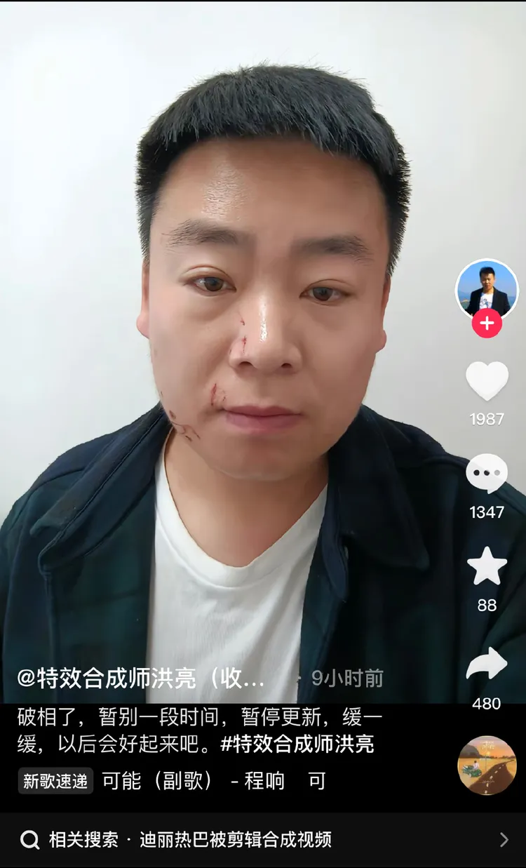 洪亮被粉絲打成豬頭。取自微博