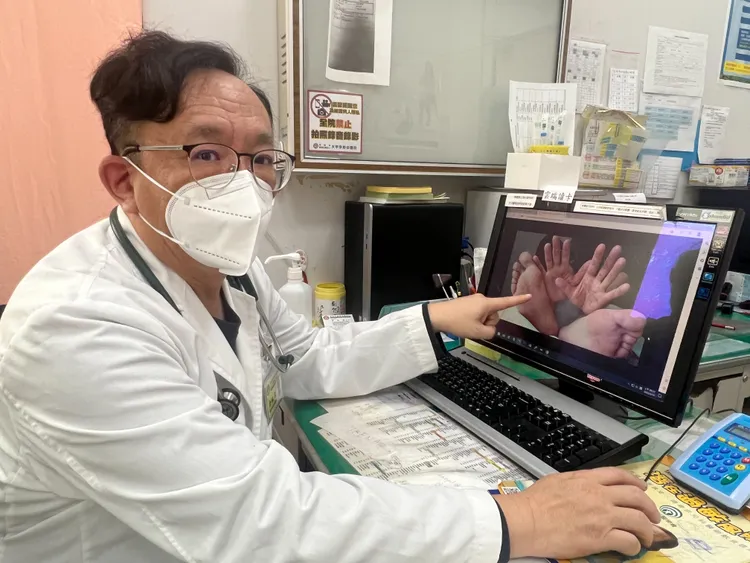 大甲李綜合醫院小兒科門診最近出現腸病毒個案，醫師余秋霖提醒家長需督促孩童勤洗手。大甲李綜合醫院提供