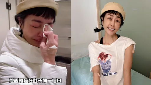 唐玲胃癌4期醫生曝「動刀剖腹10公分」　診間淚崩吐最擔心這件事