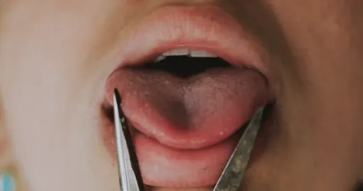 家暴父屢次對妻女下重手　還威脅要割岳母舌頭