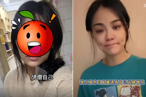 网美遭劈腿离婚!她大整形复仇「要他后悔」 网心疼:以前像马思纯
