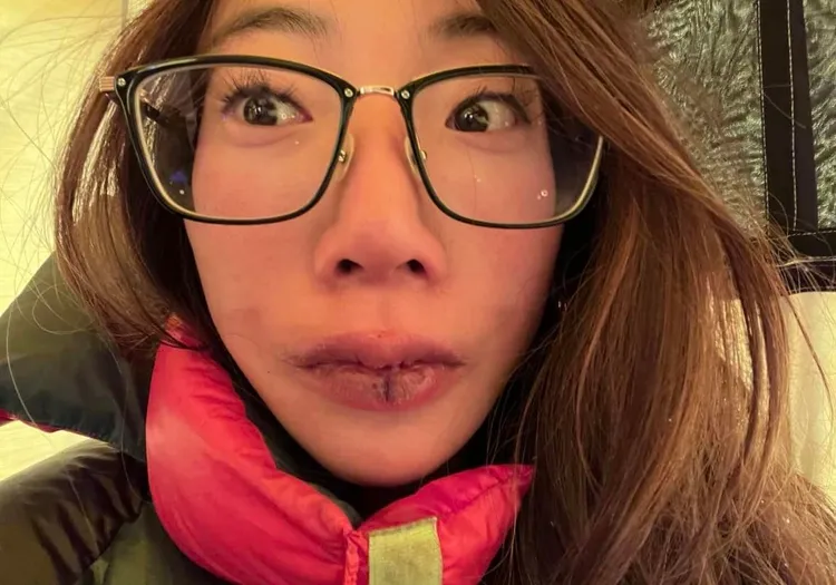 曾格爾指出，「常常嘴唇都是滲著血。」翻攝自曾格爾臉書