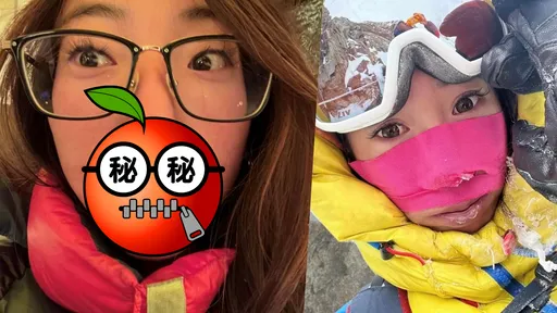 2個月沒洗澡是基本!登山女神貼濺血6大傷勢照 不斷問自己:為什麼?