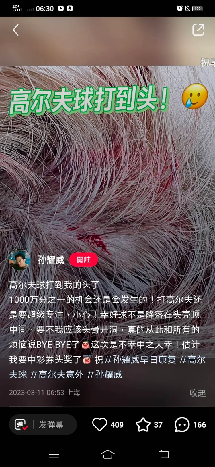 男星孫耀威驚傳遭高爾夫球打到頭的意外，當場鮮血直流。翻攝《孫耀威》小紅書