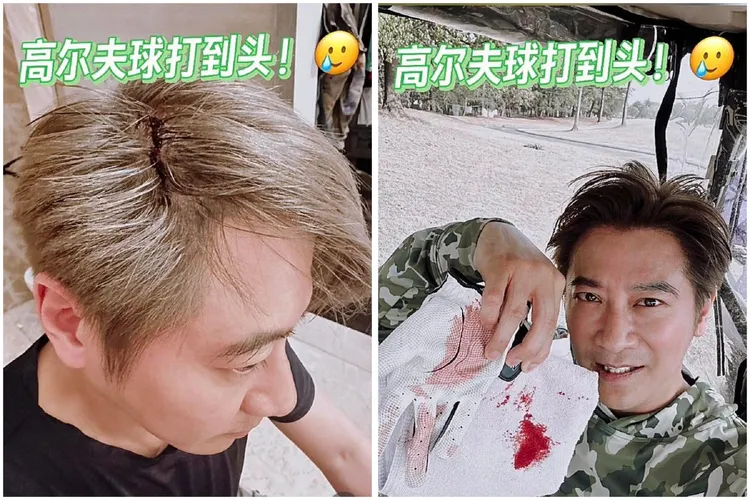 男星孫耀威驚傳遭高爾夫球打到頭的意外，當場鮮血直流。翻攝《孫耀威》小紅書