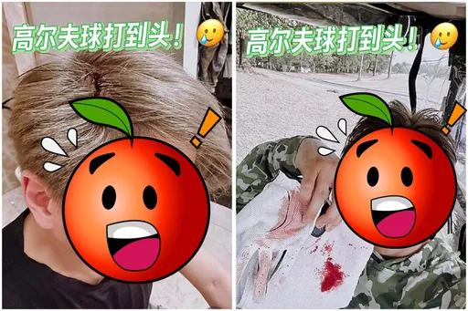 男星遭高爾夫球K破頭 5公分傷口鮮血直流!駭人畫面曝