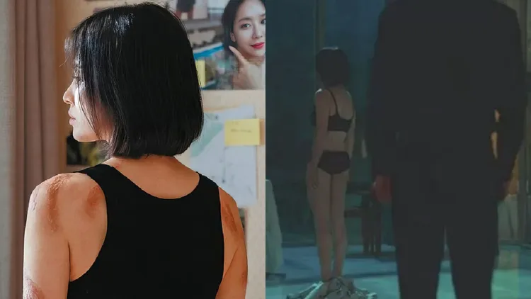 宋慧喬花4、5個小時化燙傷妝，為了脫掉外衣秀傷疤的橋段節食，連水都不喝。翻攝Netflix