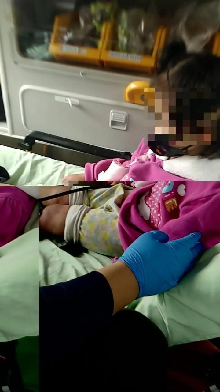 3歲女童被無照保母夫妻輪流打傷，只因在樓梯上玩耍。翻攝臉書