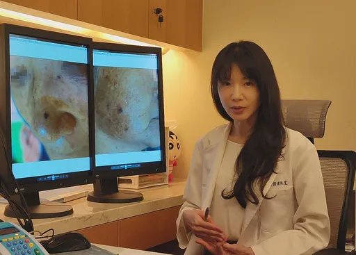 导游、农妇罹皮肤癌　美女医揪病原！吁「高危险群」做好这件事